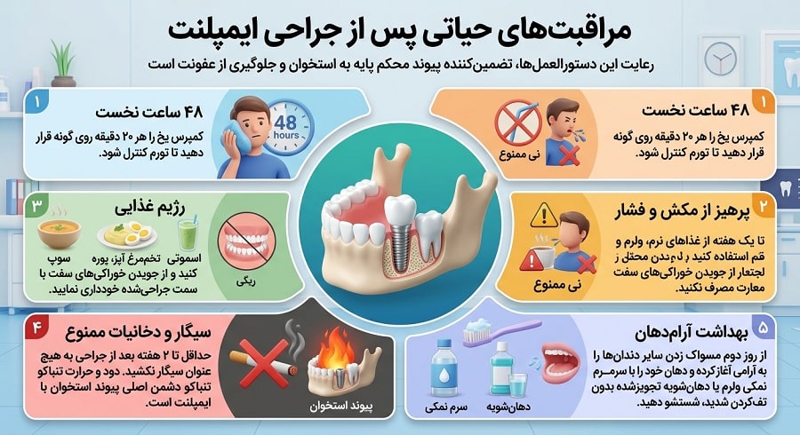 راهنمای 0 تا 100 ایمپلنت دندان