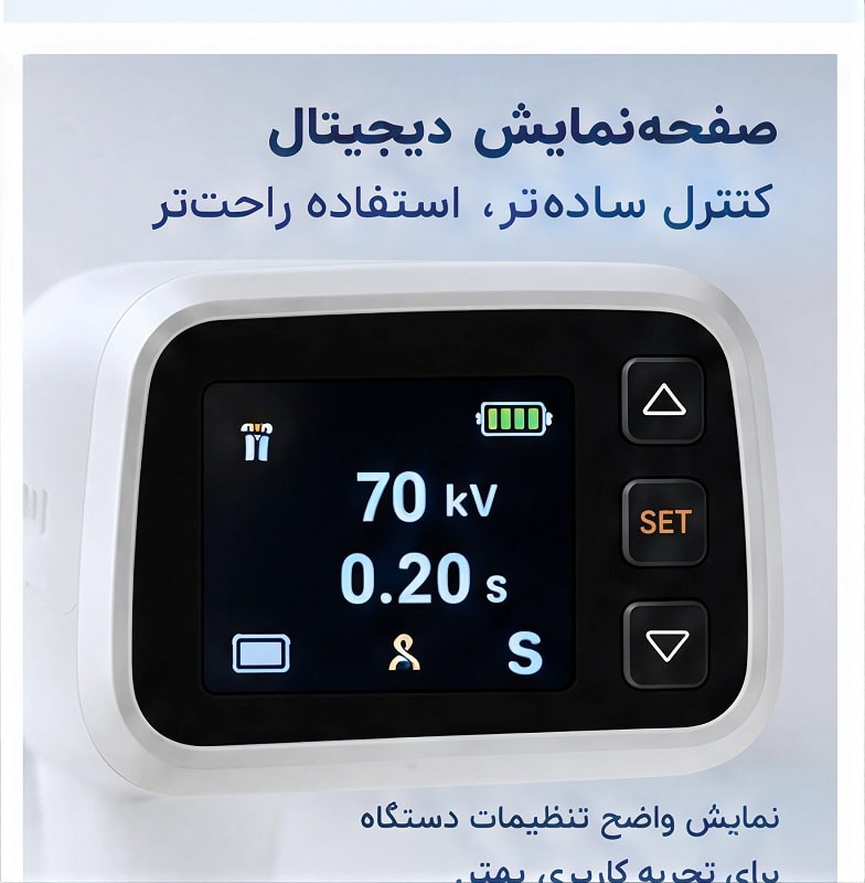 راهنمای-جامع-خرید-رادیوگرافی-mini-ray