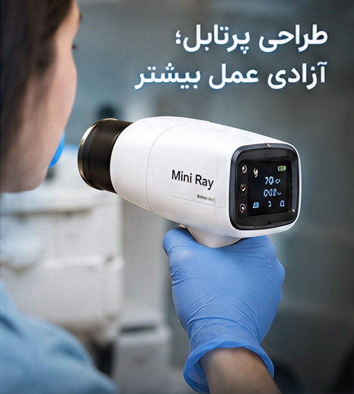 راهنمای-جامع-خرید-رادیوگرافی-mini-ray